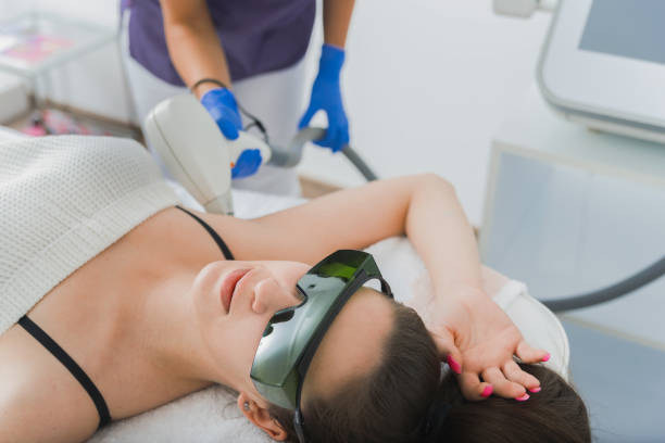 istock Laser epilation for hair removal 1151795487