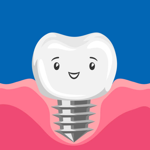 Illustration of smiling tooth implant. Illustration of ssmiling tooth implant. Children dentistry happy character. Kawaii facial expression. cute cartoon dental implants stock illustrations