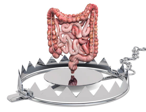 istock Abdominal pain concept. Human intestines inside bear trap. 3D rendering isolated on white background 1151858720