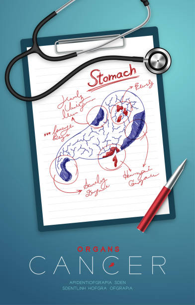 stomach-cancer-and-infection- stomach-cancer-and-infection-