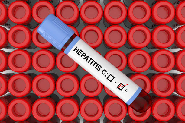 анализ крови колбу трубки с гепатитом с положительный результат над рядами тест колбы трубки. 3d рендеринг - hepatitis virus стоковые фото и изображения