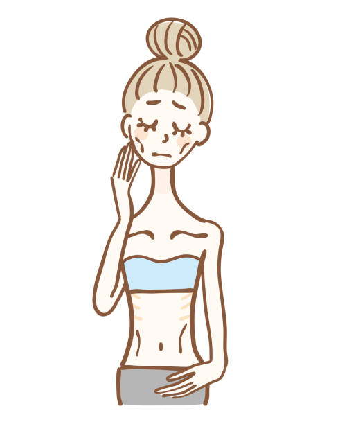 Illustration of anorexia nervosa woman Illustration of anorexia nervosa woman malnourished stock illustrations