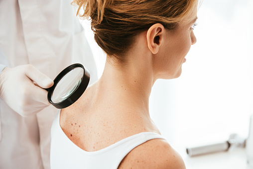 vista recortada del dermatólogo que sostiene la lupa mientras examina a la mujer con melanoma photo