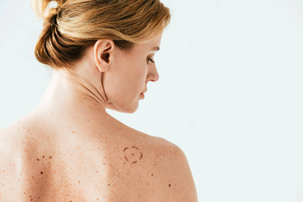 istock attractive woman with marks on back isolated on white 1152216003