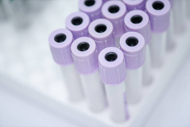 istock Many laboratory tube on the white background 1152228372