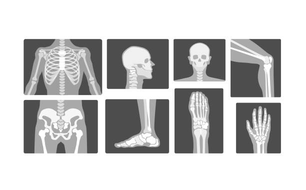 creative radiology skeleton bones vector realistische röntgen-logo-design-illustration - x ray x ray image human hand anatomy stock-grafiken, -clipart, -cartoons und -symbole