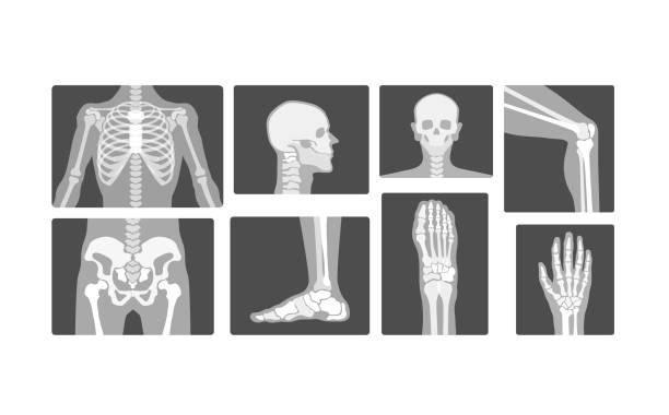 творческая радиология скелет кости вектор реалистичный рентгеновский логотип дизайн иллюстрация - human bone illustrations stock illustrations