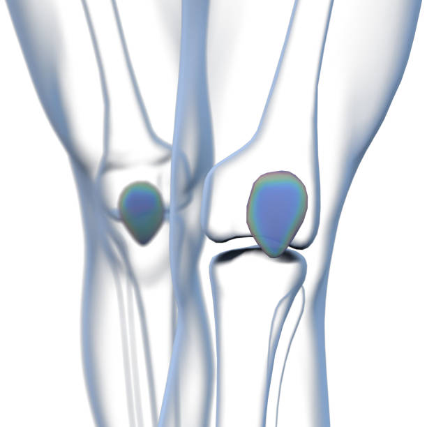 istock 3d rendering  medical illustration of the patella bone 1152322852