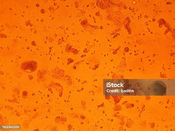 Virus Micro Cell Virus Micro Organism View From Microscope Stock Photo - Download ...