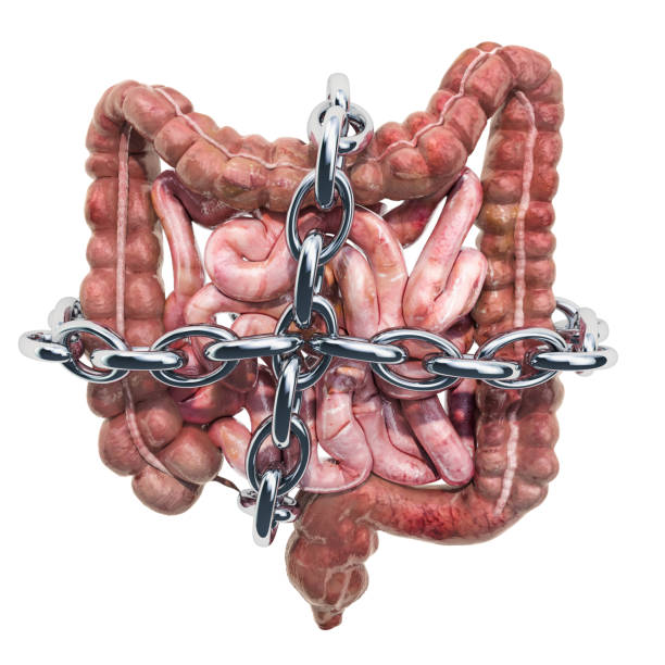 istock Human intestines with chain. Abdominal pain concept 1152381285