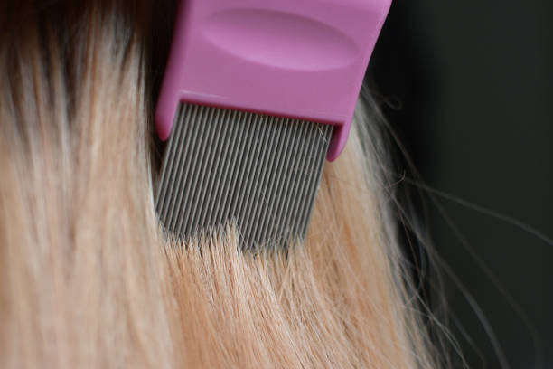 combing blond hair with a lice comb - ectoparasite imagens e fotografias de stock