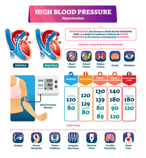 높은 혈압 벡터 일러스트입 니다. 레이블이 지정 된 수축 기 설명 구성표 - 고혈압의 stock illustrations