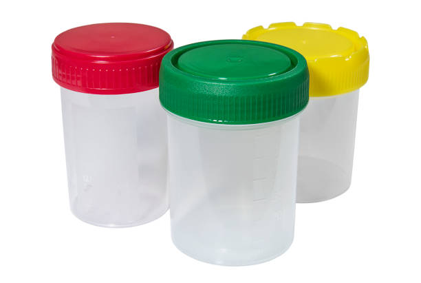 istock Plastic containers for the collection of biological material with multicolored caps 1152651714