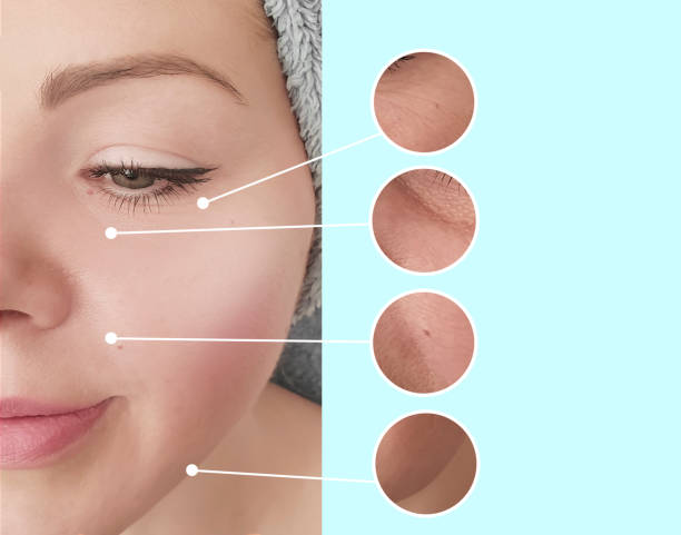 istock woman face wrinkles before and after correction collage 1152663035