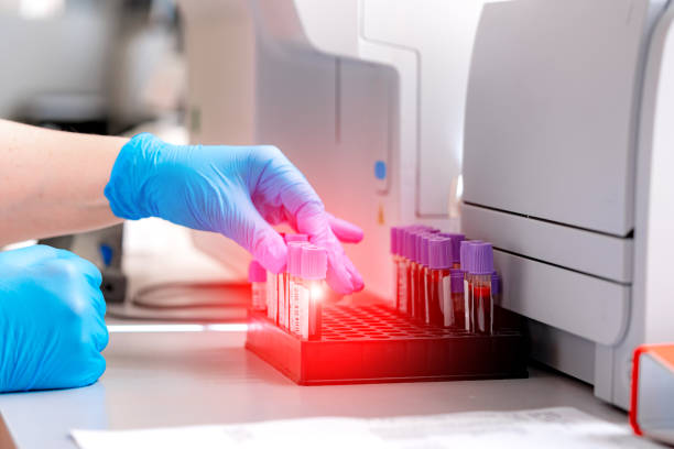 女性の手のクローズアップは、自動化されたマシンからの血液とチューブを充填します。 - vial laboratory test tube biotechnology ストックフォトと画像