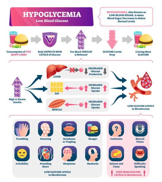 hypoglykämie-vektorabbildung. etiketten als medizinisches schema mit niedrigem zuckergehalt. - hypoglykämie stock-grafiken, -clipart, -cartoons und -symbole