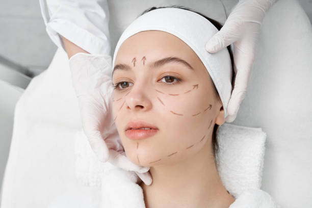 istock Woman with black surgical marks for correction. 1152779081
