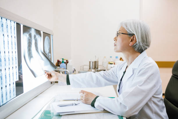 Side view of senior female doctor looking at chest x ray Japanese doctor examining xray at light box, healthcare, decisions, diagnosis x ray results stock pictures, royalty-free photos & images