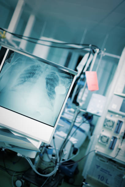 Emergency room with patient in bed surrounded by technical equipment and x-ray image of chest Emergency room with patient in bed surrounded by technical equipment and x-ray image of chest. roentgen stock pictures, royalty-free photos & images