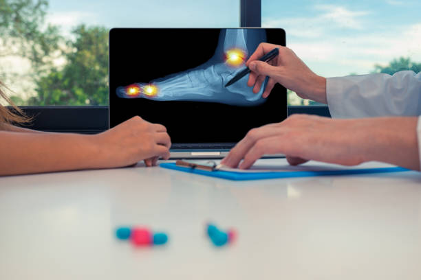 врач показывает рентген стопы и боль на ногах и лодыжке на ноутбуке па�циентке. таблетки на столе - gout стоковые фото и изображения