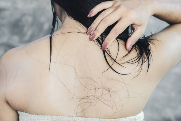 脱毛によるヘルスケアの問題は、シャワー後のアジア女性の背中に落ちる - 薄毛 ストックフォトと画像