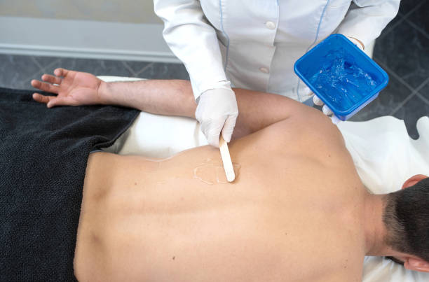 Young Man in Spa Salon Receiving Laser Epilation - fotografia de stock