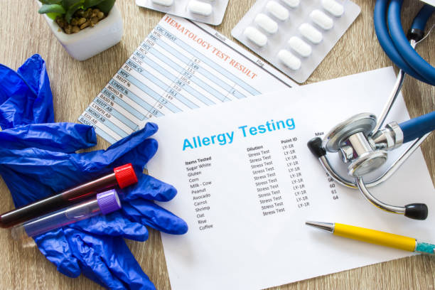 Result of allergy testing on working table in working environment of doctor of internal medicine, allergologist, general practice, pediatrician top view top-down photo surrounded by stethoscope, drugs Result of allergy testing on working table in working environment of doctor of internal medicine, allergologist, general practice, pediatrician top view top-down photo surrounded by stethoscope, drugs allergy test stock pictures, royalty-free photos & images