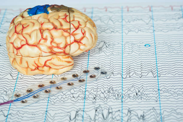 menschliches gehirnmodell und elektrodenaufnahmen von gehirnwellen auf backgro - eeg epilepsy science electrode stock-fotos und bilder