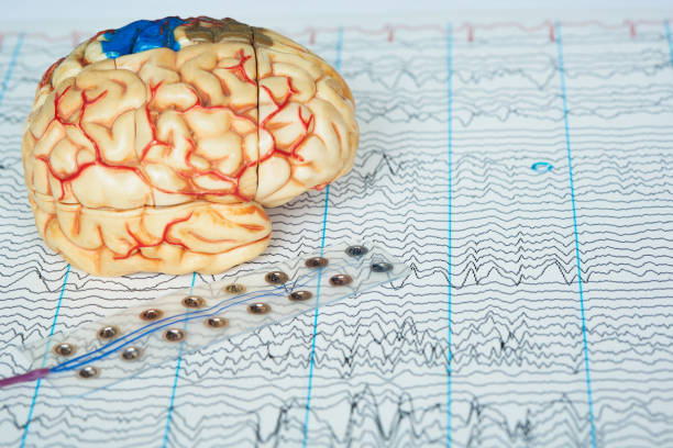 modello cerebrale umano ed elettrodo che registra le onde cerebrali sul backgro - eeg epilepsy science electrode foto e immagini stock