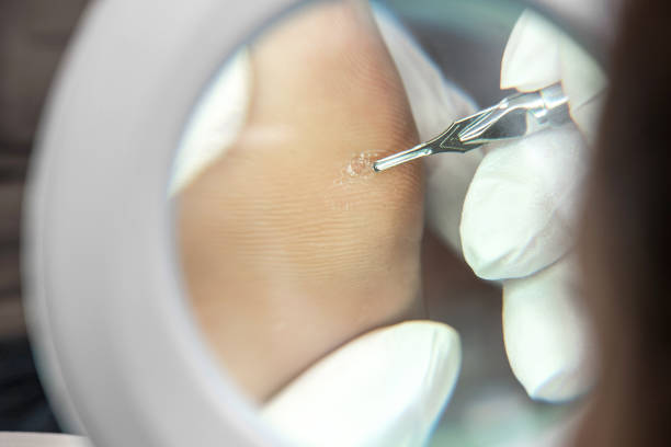 Professional Pedicure Using Electric Machine to Remove Foot Calluses - fotografia de stock