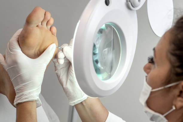 Professional Pedicure Using Electric Machine to Remove Foot Calluses - fotografia de stock