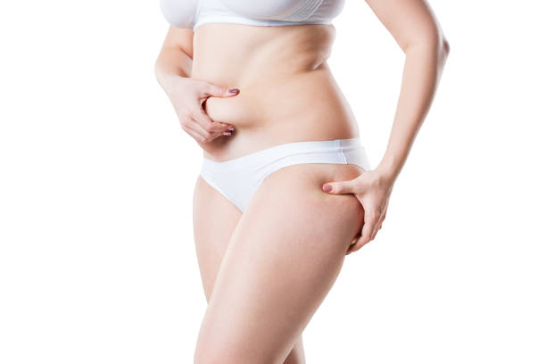 donna in sovrappeso con pancia flaccida e fianchi grassi, obesità corpo femminile isolato su sfondo bianco - liposuction foto e immagini stock