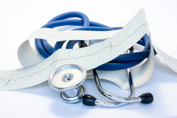 Diagnosis, treatment and prevention of diseases of heart and cardiovascular system concept photo. Blue stethoscope is surrounded by tape of ECG with electrocardiogram drawn on it. Diagnosis of disease diagnóstico, tratamiento y prevención de enfermedades de la foto del concepto del corazón y del sistema cardiovascular. el estetoscopio azul está rodeado por una cinta de ecg con un electrocardiograma dibujado en él. diagnóstico de enfermedades