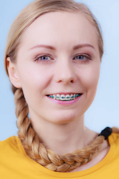 istock Woman showing her teeth with braces 1153903707