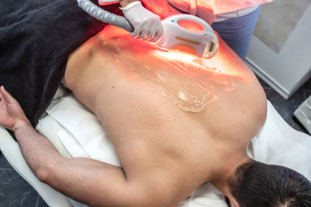 молодой человек в спа-салоне получает лазерную эпиляцию - laser therapy medical laser light therapy стоковые фото и изображения