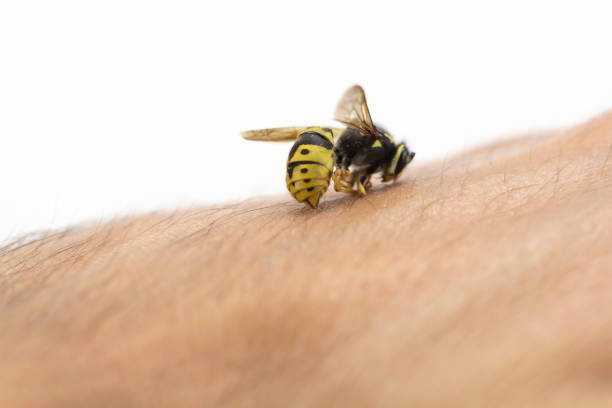 bee stinging in human hand - stinging imagens e fotografias de stock