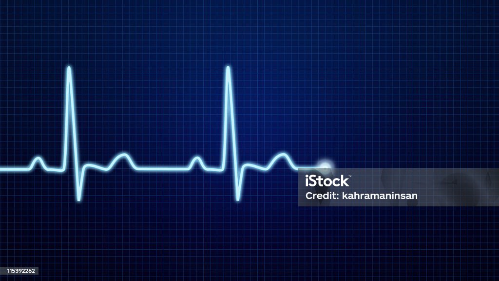 El ECG onda senoidal de impulsos - Foto de stock de Latido cardíaco libre de derechos