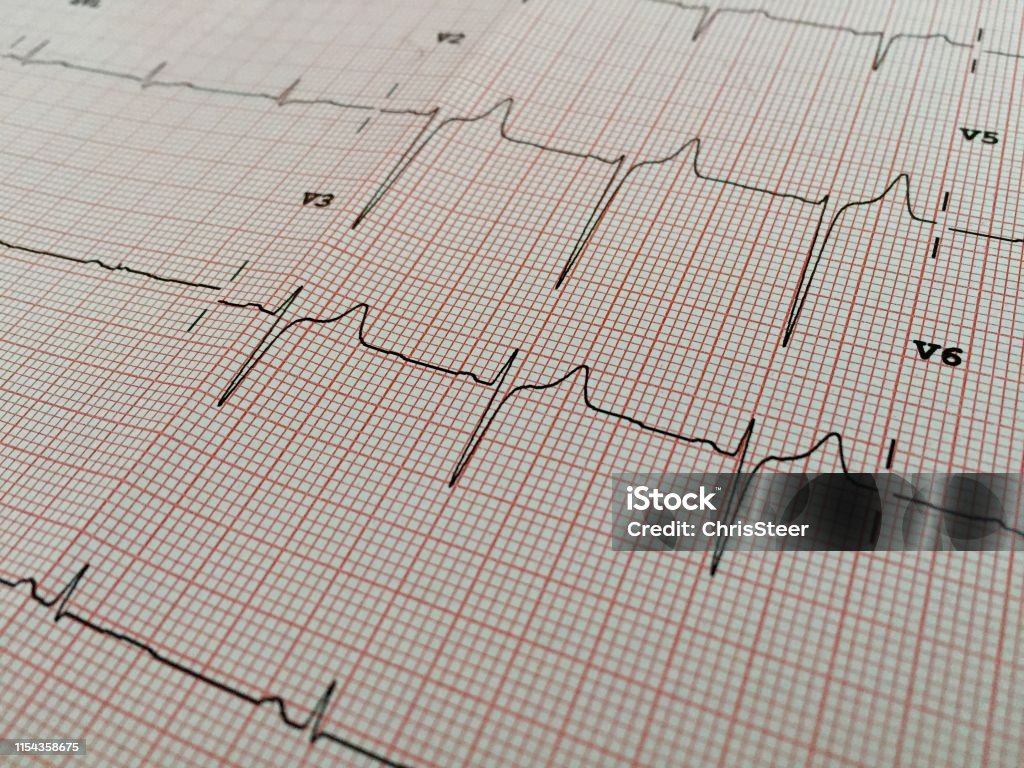 electrocardiogram ECG Analyzing Stock Photo