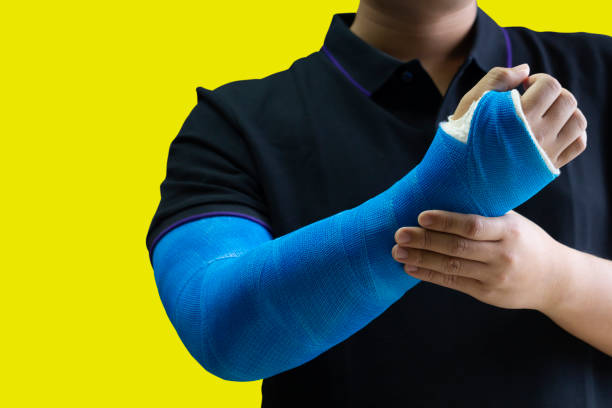 腕の損傷の概念として青い包帯と手を握る人を閉じる。コピースペースのある黄色の背景に分離されています。 - hospital physical injury patient men ストックフォトと画像