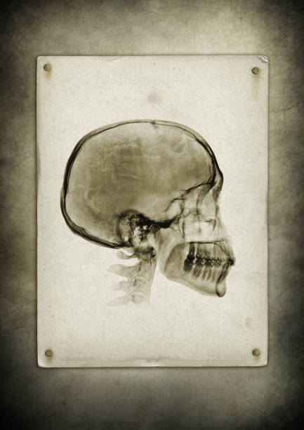 istock X-ray skull on a vintage paper background 1154428440