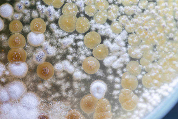 istock Study Colony characteristic of Actinomyces, Bacteria, yeast and Mold on selective media from soil samples for study in laboratory microbiology. 1154550913