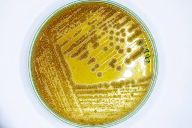 colonia di studio caratteristica di actinomyces, batteri, lievito e muffa su mezzi selettivi da campioni di suolo per lo studio in microbiologia di laboratorio. - medium group of animals immagine foto e immagini stock