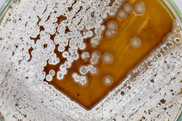 istock Study Colony characteristic of Actinomyces, Bacteria, yeast and Mold on selective media from soil samples for study in laboratory microbiology. 1154554062