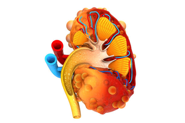 istock Kidney disease. Kidney cross section 1154558501