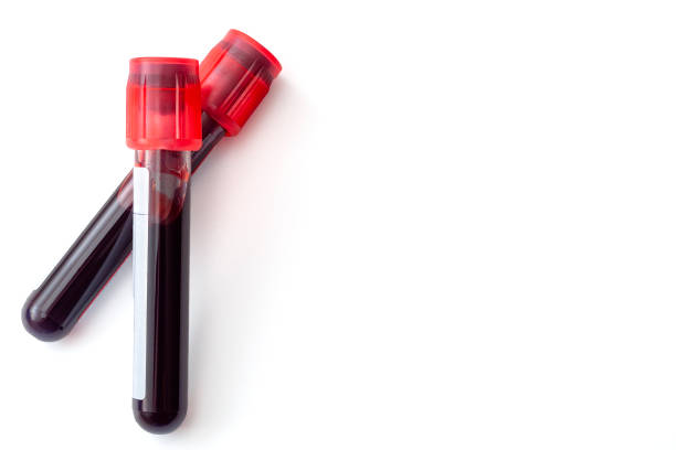 Phlebotomy, biochemical analysis, laboratory exam and blood testing concept theme with two test tubes isolated on white background with copyspace Phlebotomy, biochemical analysis, laboratory exam and blood testing concept theme with two test tubes isolated on white background with copy space blood plasma stock pictures, royalty-free photos & images