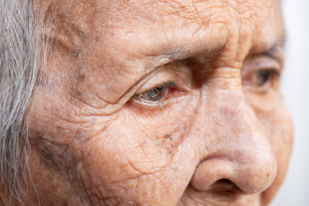istock The old woman's felling lonely.(dementia and Alzheimer’s disease) 1154719596