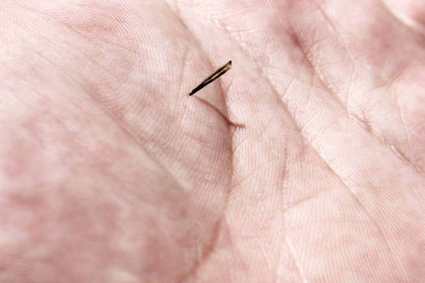 A splinter or thorn in the hand of a close-up. A splinter or thorn in the hand of a close-up. sliver stock pictures, royalty-free photos & images