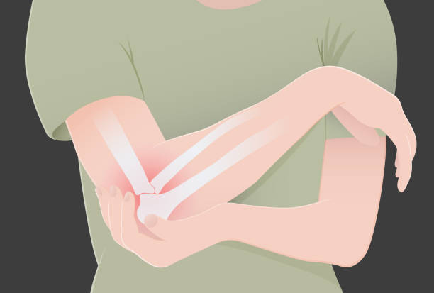 uraz kości łokcia - pain elbow physical therapy inflammation stock illustrations