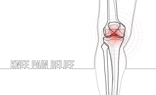 무릎 통증 완화에 대 한 흰색 수평 연속 라인 드로잉 개념 배너. - pain human knee arthritis human joint stock illustrations