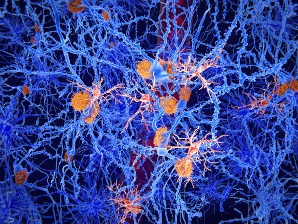 Microglia cells (red) play an important role in the pathogenesis of Alzheimer's disease Microglia are specialised macrophages that restrain the accumulation of ß-amyloid (plaques in orange). On the other side, once activated, they can have harmful influences in Alzheimer's disease, segregating inflammatory factors and mediating the engulfment of synapses. atrophy photos stock pictures, royalty-free photos & images
